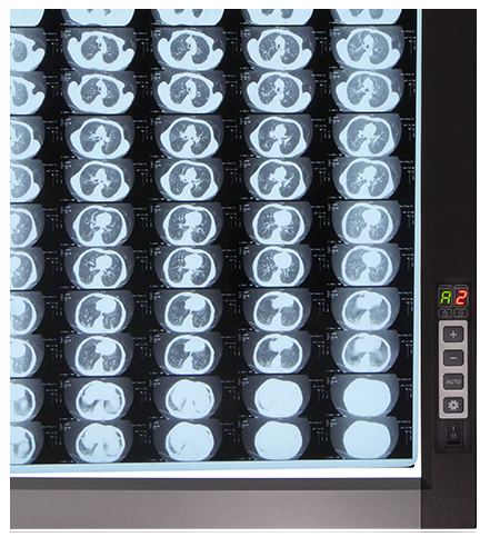 Світлодіодний медичний негатоскоп ZG-2D - изображение 2