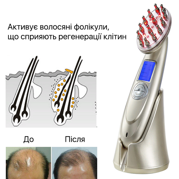 Электрическая расческа Skinyang для стимуляции роста волос с функцией RF лифтинга Золотой (0197) - изображение 8