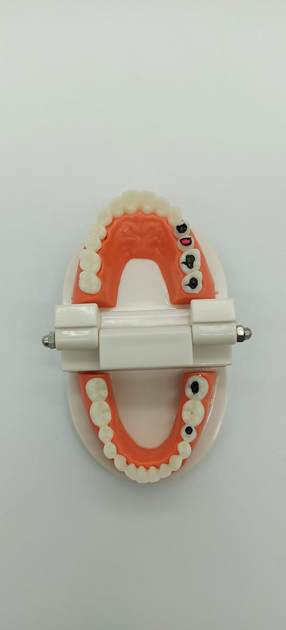 Модель стоматологічна з карієсом фантом - зображення 2