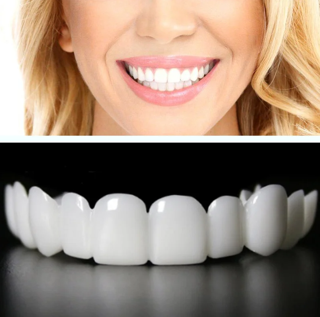 Съемные пластиковые виниры для зубов Veneers Snap On для быстрой временной реставрации зубов на оду челюсть + бокс для хранения - Фото 3 Съемные пластиковые виниры для зубов Veneers Snap On для быстрой временной реставрации зубов на оду челюсть + бокс для хранения - изображение 3