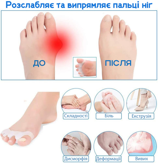 Силіконовий коректор-роздільник для пальців ніг Clefers ToeSep 35- Лікування кісточки (500448) 1 пара - зображення 2