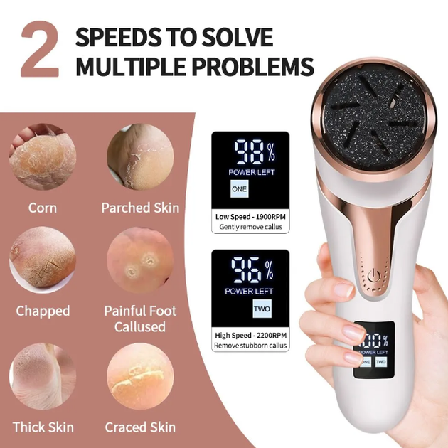 Электрическая пилка-пемза для пяток для педикюра Rechargeable Callus Remover MT-510 с LCD дисплеем - изображение 3