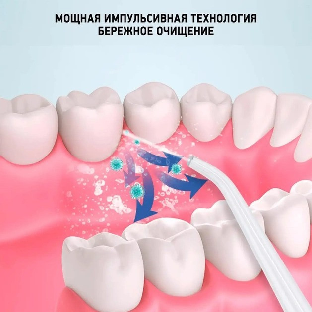 Портативный ирригатор для чистки зубов, десен и полости рта Power-floss Shining Ipx7 LY-314 - изображение 11