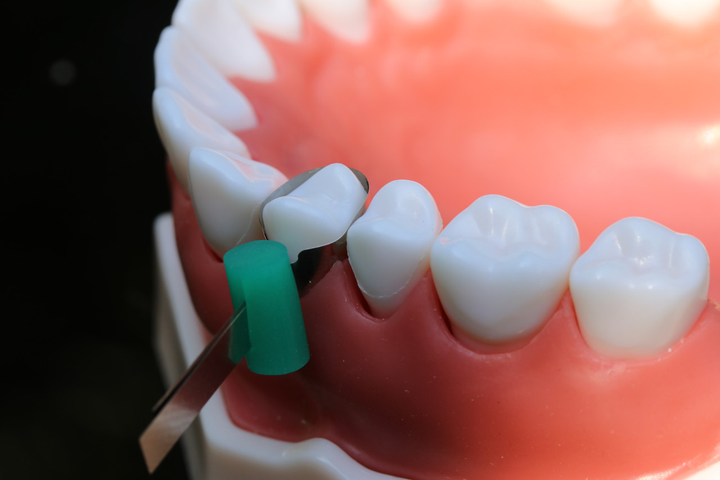 Стоматологічні матриці для жувальної групи зубів 50шт Super Mat - зображення 2