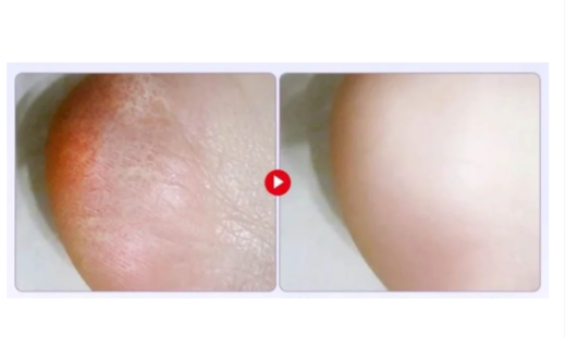 Пілінг маска для ніг Horse Oil Soft Exfoliating 40г, що відлущує Gebaolian (II) 31934 - Фото 4 Пілінг маска для ніг Horse Oil Soft Exfoliating 40г, що відлущує Gebaolian (II) 31934 - зображення 4