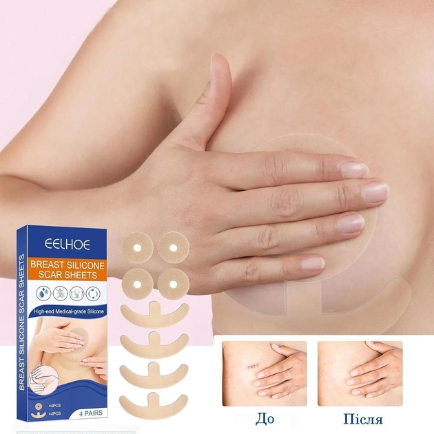 Силіконовий пластир для грудей від рубців Breast Silicone Scar Sheets - изображение 1