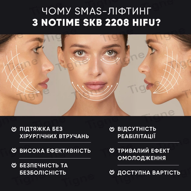 Профессиональный HIFU аппарат для SMAS лифтинга лица NOTIME SKB-2208 HIFU - изображение 8