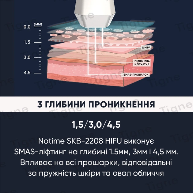 Профессиональный HIFU аппарат для SMAS лифтинга лица NOTIME SKB-2208 HIFU - изображение 11