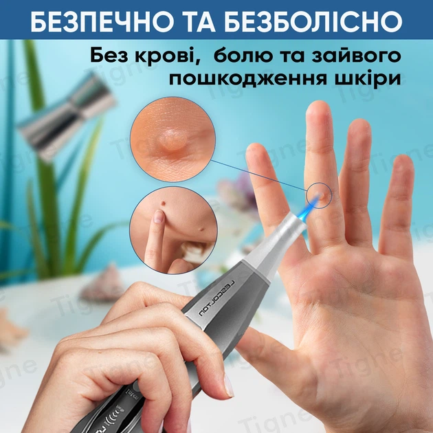 Коагулятор лазерный для удаления папилом татуировок перманентного макияжа аппарат Laser Picosecond LESCOLTON LS-830 - изображение 7