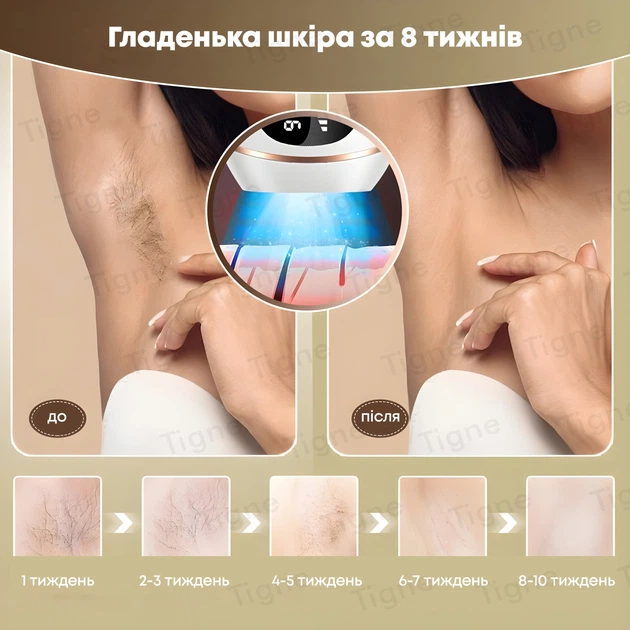 Фотоэпилятор IPL 999 999 вспышек с функцией охлаждения LESCOLTON T118 - изображение 9
