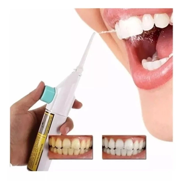 Іригатор для порожнини рота A-Plus Power Floss Z3 механічний для чищення зубів та брекетів - зображення 7