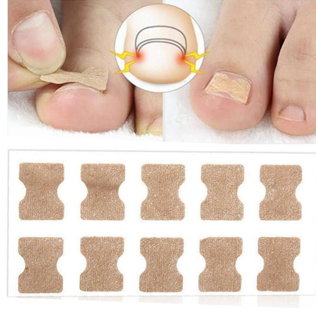 Пластир для корекції врослого нігтя Toenail Correction Sticker 60 шт - зображення 2