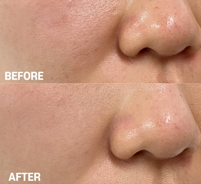 Крем для сужения пор Tiam Pore Minimizing 21 Cream 60 мл - Фото 6 Крем для сужения пор Tiam Pore Minimizing 21 Cream 60 мл - изображение 6