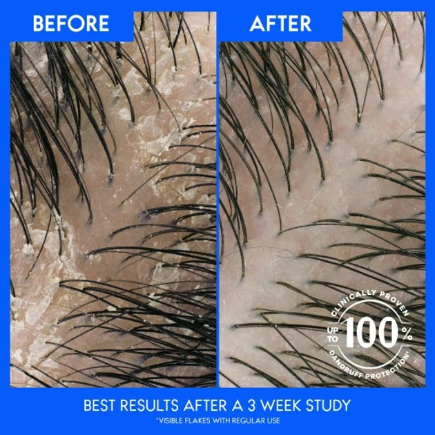 Шампунь від лупи Head & Shoulders Deep Hydration Coconut 500 мл (8700216305327) - зображення 3