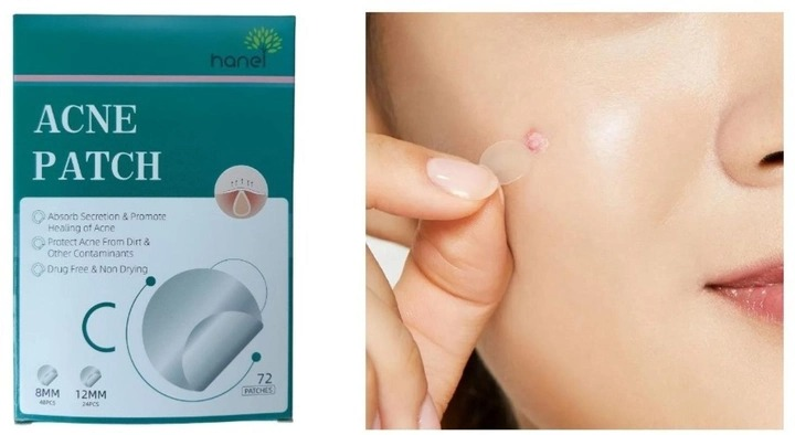 Пластир, патчі від бородавок та прищів Acne Patch від акне та запалень 72 шт 1 уп (AP-1000) - зображення 6
