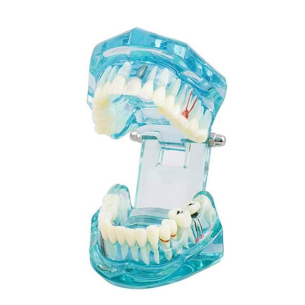 Модель стоматологическая демонстрационная (разборная) - изображение 1