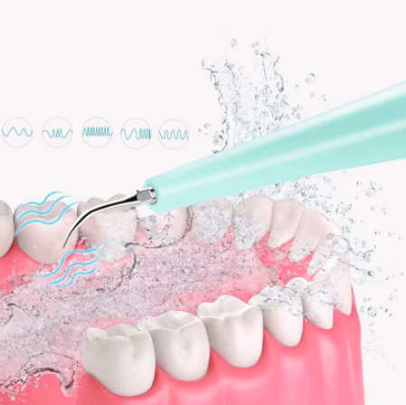 Скалер очиститель зубов от камня Dental Calculus Blue - изображение 4
