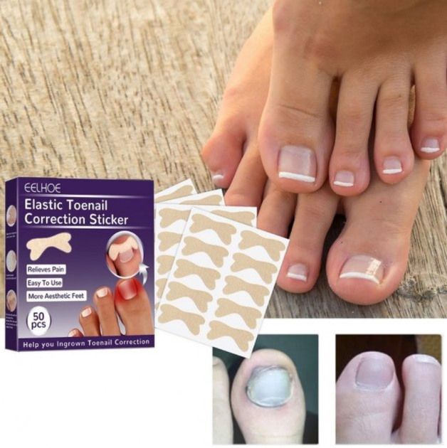 Пластыри для вросших ногтей Elastic Toenail 50 pcs - изображение 2