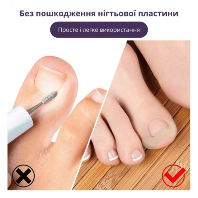 Пластыри для вросших ногтей Elastic Toenail 50 pcs - изображение 4