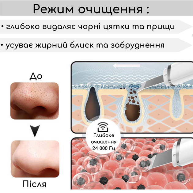 Ультразвуковой уз скрабер Swan MSY-C7 с ионизацией для очищения улучшения текстуры кожи лица удаления черных точек профессиональный уход очищает поры мощный аппарат для обновление клеток домашнего и профессионального использования белый - изображение 4
