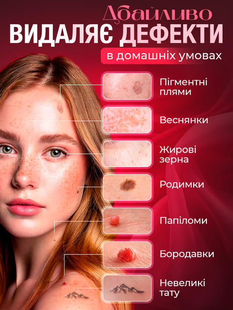 Электрокоагулятор плазменный косметологический прибор для удаления ...