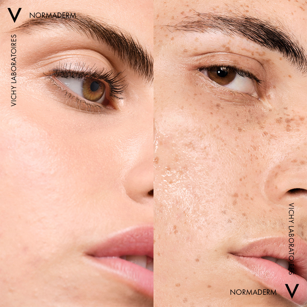 Тонік для обличчя Vichy Normaderm очищуючий 200 мл (3337871320751) - зображення 5