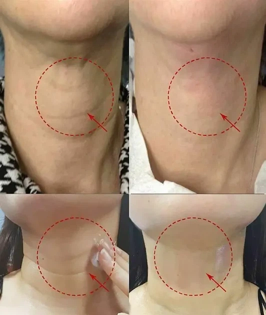 Крем для шеи и декольте Medi-Peel Naite Thread Neck Cream 100 мл - изображение 2
