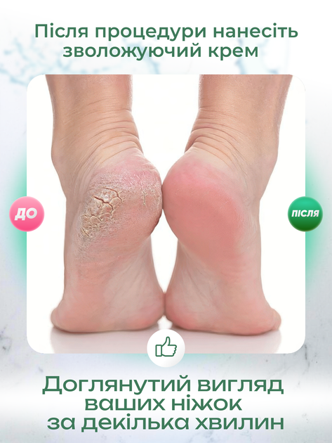 Электрическая пилка электро пемза для пяток и ног электропемза роликовая шлифовальная машинка на батарейках для удаления мозолей (CR-02) - изображение 3