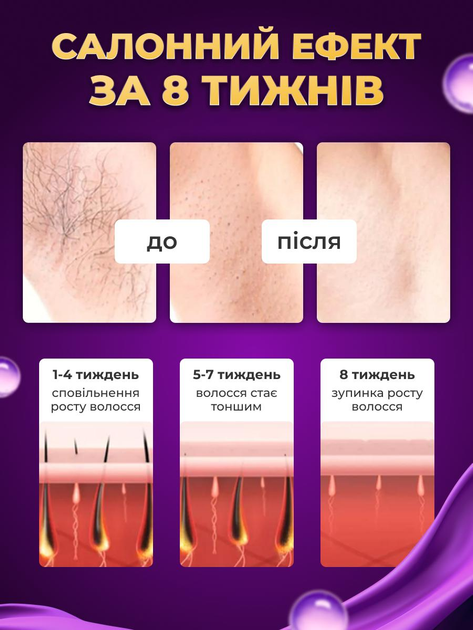 Фотоепілятор жіночий лазерний епілятор з функцією охолодження компактний 5 рівнів інтенсивності для епіляції будь якого типу шкіри без подразнень - зображення 7