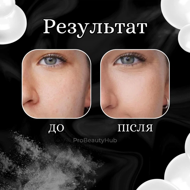 Тоник для лица Bel Tono с гранатом и зеленым чаем 200 мл (0670087873356) - изображение 7