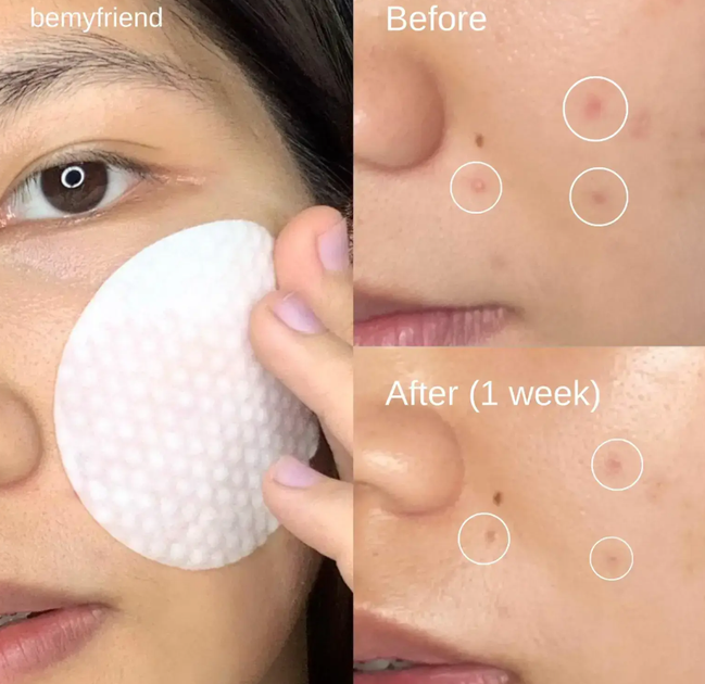 Пилинг пады для очистки и сужения пор Medicube Zero Pore Pads 2.0 70 шт - Фото 6 Пилинг пады для очистки и сужения пор Medicube Zero Pore Pads 2.0 70 шт - изображение 6