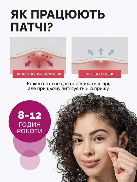 Патчи Reclaire от прыщей и акне 72 шт (2000962946123) - изображение 6