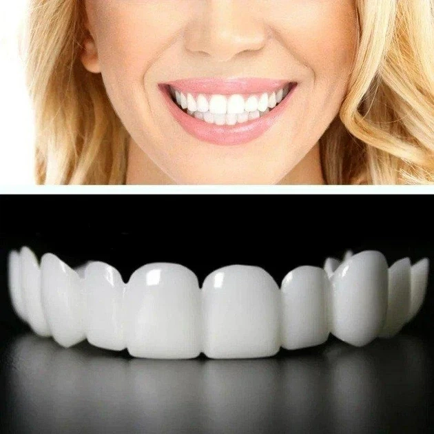 Знімні вініри для зубів Veneers smile, накладні зуби верх і низ у кейсі - зображення 5