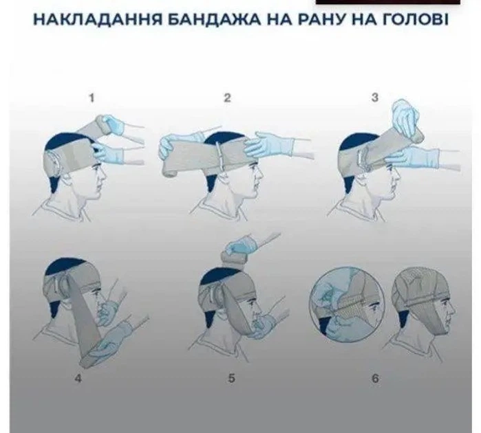 Бандаж Sісn ізраїльський 6" SІЧ з фіксуючою скобою - зображення 6