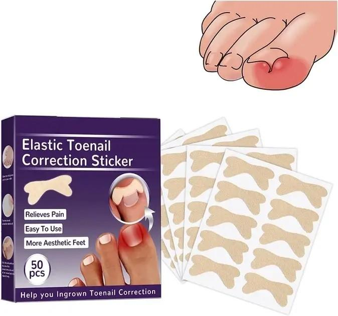 Набор пластырей для коррекции врастающих ногтей Elastic Toenail Correction Sticker 50 шт (2104618421) - изображение 1