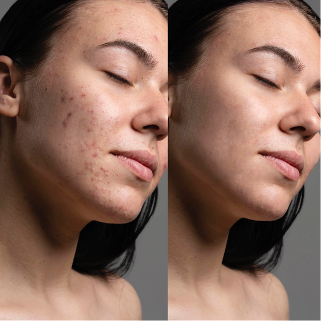 Вакуумний очищувач шкіри та пор Medica+ SKINCLEANER 9.0 WT - зображення 13
