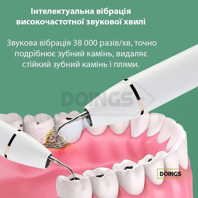 Профессиональный ультразвуковой скейлер эндоскоп для удаления зубного камня CARPRIE NDR-03 White - изображение 2