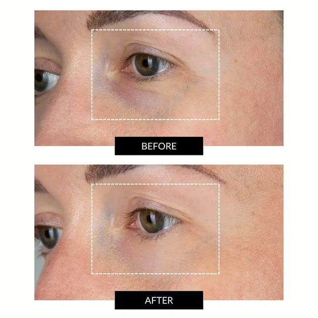 Светодиодная маска CurrentBody Skin LED Eye Perfector для кожи