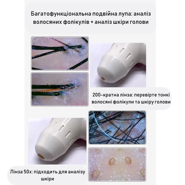 Трихоскоп для осмотра кожи головы с 10-дюймовым дисплеем Lupe трихологическая 50 / 200-кратная лупа с двумя объективами, 28.5х13 см, белый (102672127) - Фото 7 Трихоскоп для осмотра кожи головы с 10-дюймовым дисплеем Lupe трихологическая 50 / 200-кратная лупа с двумя объективами, 28.5х13 см, белый (102672127) - изображение 7
