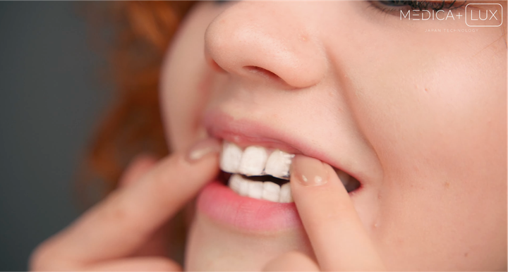 Отбеливающие полоски MEDICA+ 3DWhite Strips - Фото 4 Отбеливающие полоски MEDICA+ 3DWhite Strips - изображение 4