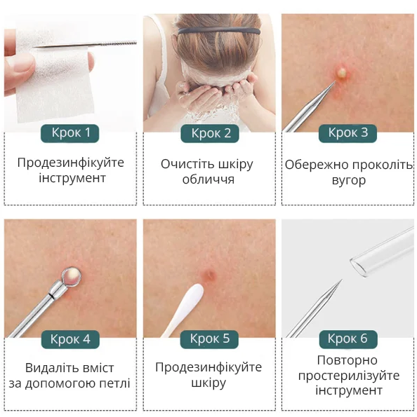 Инструмент для чистки лица, набор для чистки лица 8 шт - изображение 7