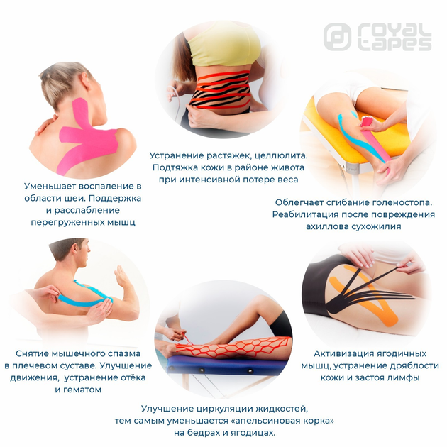 Кинезио Тейп Royal Tapes body care Синий - изображение 4