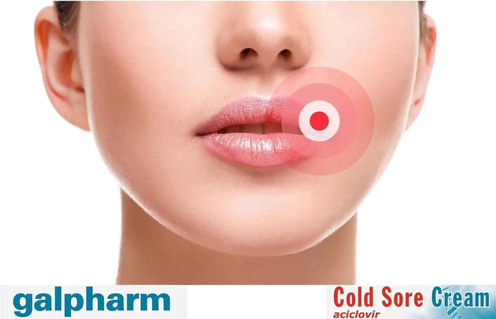 Крем від герпесу, Cold Sore Cream aciclovir, Galpharm, 2гр - зображення 2