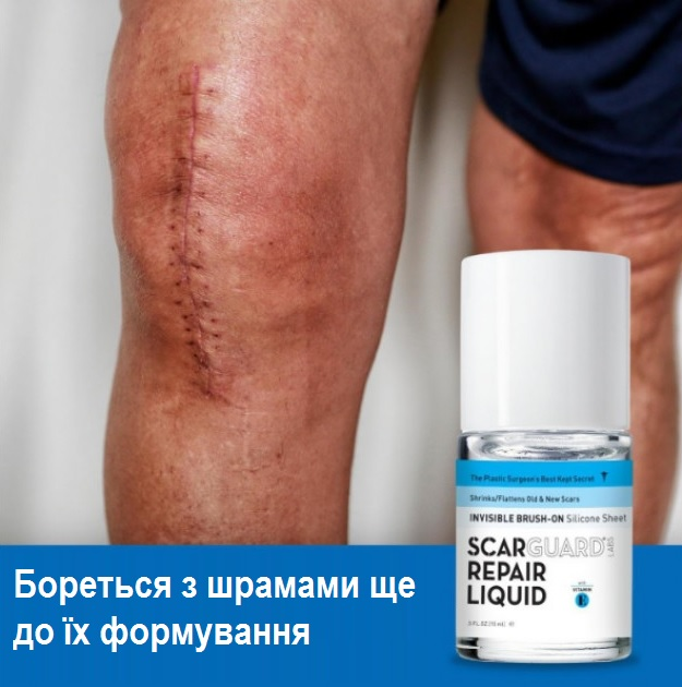 Гель против рубцов и шрамов для лица и тела Scarguard Scar Repair Liquid с витамином Е 15 мл - изображение 8