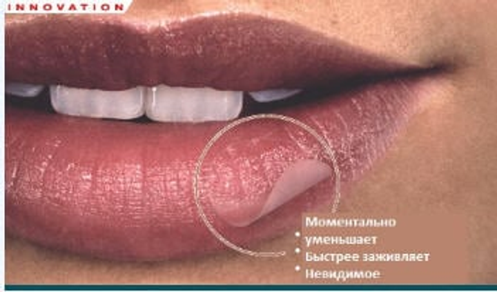 Пластир Компід Compeed Discreet Healing Patch для лікування герпесу 15 шт - зображення 2