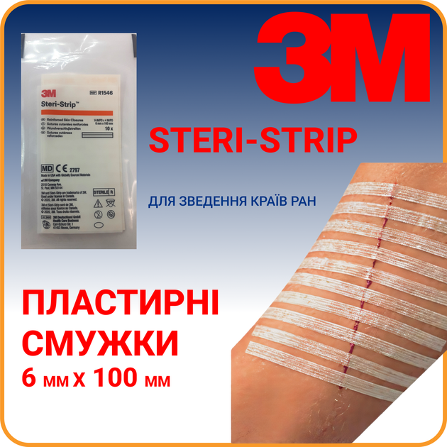 Пластирні смужки Steri-Strip™ 3M 6 мм х 100 мм (R1546) - зображення 1
