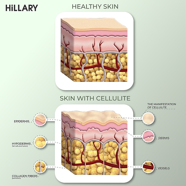 Антицеллюлитные обертывания с разогревающим эффектом - Hillary Anti-cellulite Bandage Warming Effect 100g (1066812-31020512) 