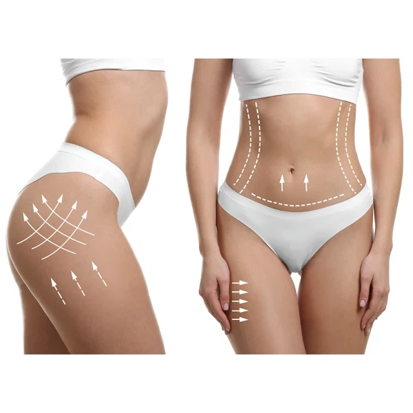 Кавітація "LIPOZERO G150", GLOBUS, Італія,42 програми - зображення 2