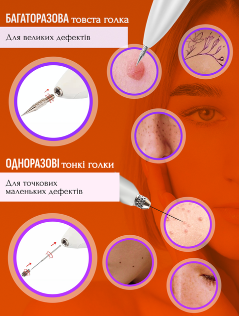 Электрокоагулятор плазменный косметологический прибор коагулятор для удаления родинок папиллом бородавок тату веснушек пигментных пятен элетро плазменная ручка Mini Freckle многофункциональный аппарат безболезненное коагулирование тканей электрокоагуагуля - Фото 6 Электрокоагулятор плазменный косметологический прибор коагулятор для удаления родинок папиллом бородавок тату веснушек пигментных пятен элетро плазменная ручка Mini Freckle многофункциональный аппарат безболезненное коагулирование тканей электрокоагуагуля - изображение 6