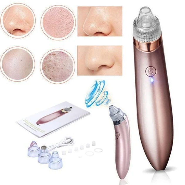 Вакуумный аппарат для чистки пор лица Beauty XN-8030 3 уровня всасывания 5 насадок - изображение 3